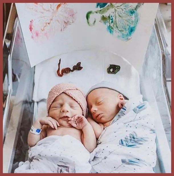 张雨绮猪油抹脸,张雨绮猪油膏