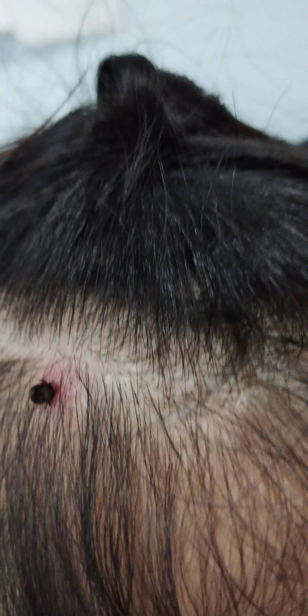 小孩头皮发痒要警惕四种疾病,3岁小孩身上发痒要警惕