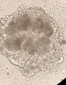 4岁娃肚大如孕妇，体内抽出2斤寄生虫液！铲屎官们注意，这虫能让你“狗带”