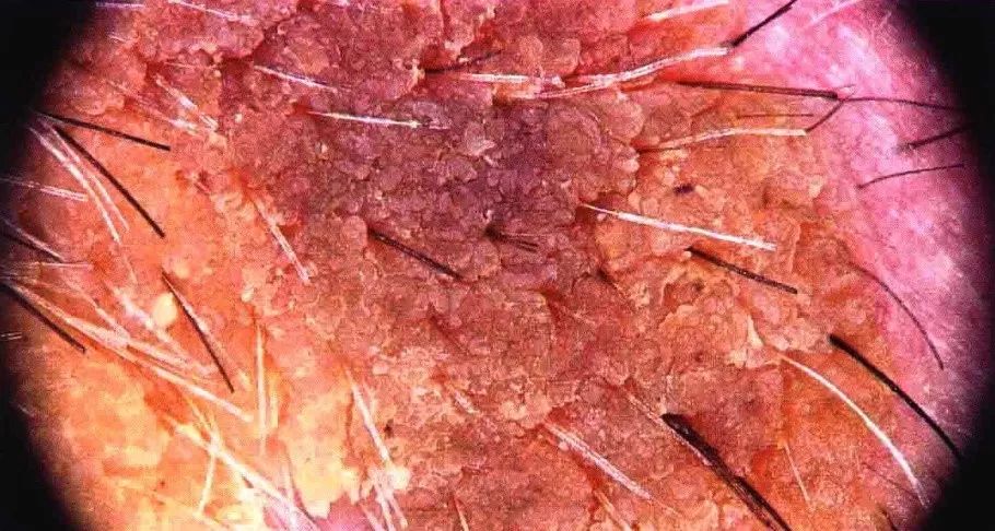 脱发属于什么问题,脱发是什么原因造成中老年