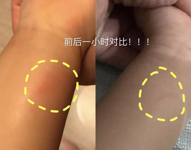 蚊子驱蚊驱虫,杀虫剂对蚊子有效又安全