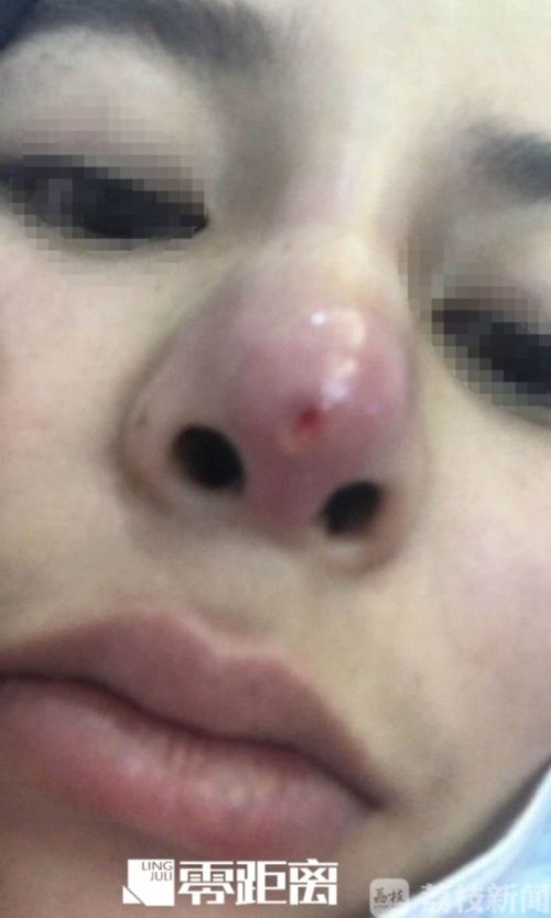 南京整形医院美容科,南京塑美整形医院