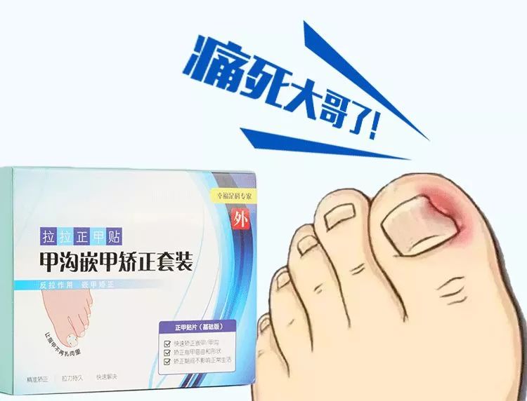 小脚趾甲长在肉里一碰就疼怎么办,指甲扎到肉里怎么处理