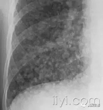 胸部解剖及常见疾病影像表现,胸部影像学基础知识