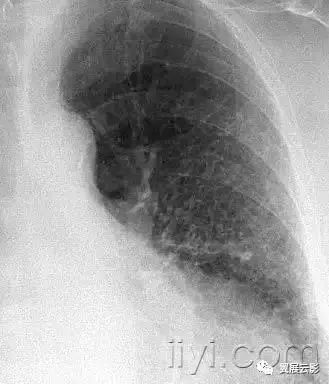 胸部解剖及常见疾病影像表现,胸部影像学基础知识