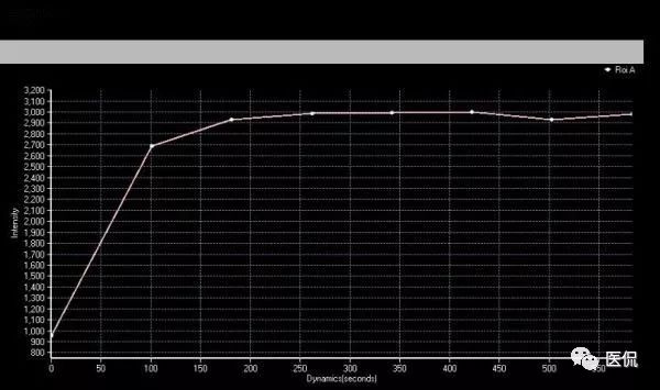 先天性乳头凹陷，MRI发现炎性病变，怎么诊断？