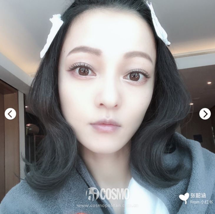 张韶涵怎么护肤的,张韶涵去闭口痘