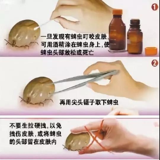 孩子7岁突然眼皮长了个黑点,2岁小孩眼睛上突然长了一颗黑痣