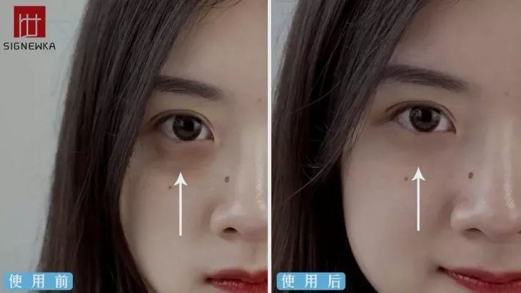 德国变态震动棒,啪啪啪间抚平眼袋、黑眼圈!不用开刀,就能让你年轻十岁!