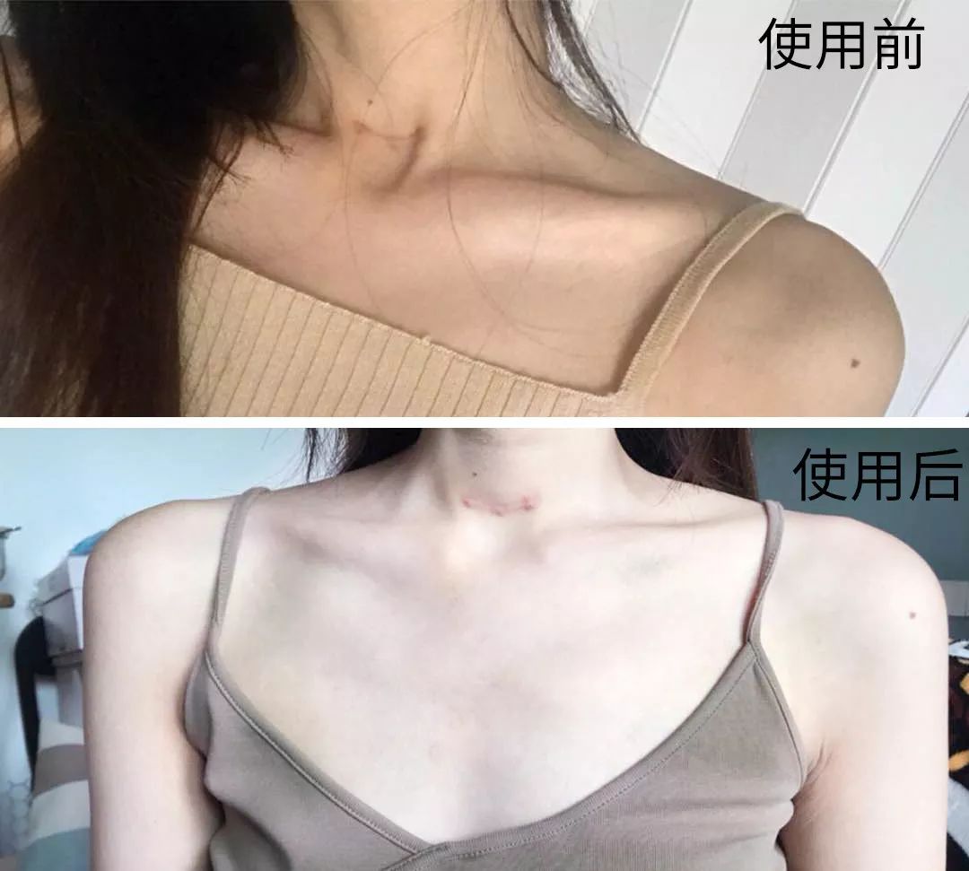 液体*袜丝**是什么鬼？用过的妹子都尖叫！黑腿瑕疵都没了