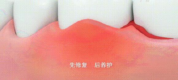 俄罗斯牙膏去黄牙怎么样,祛牙垢黄牙的牙膏国货之光