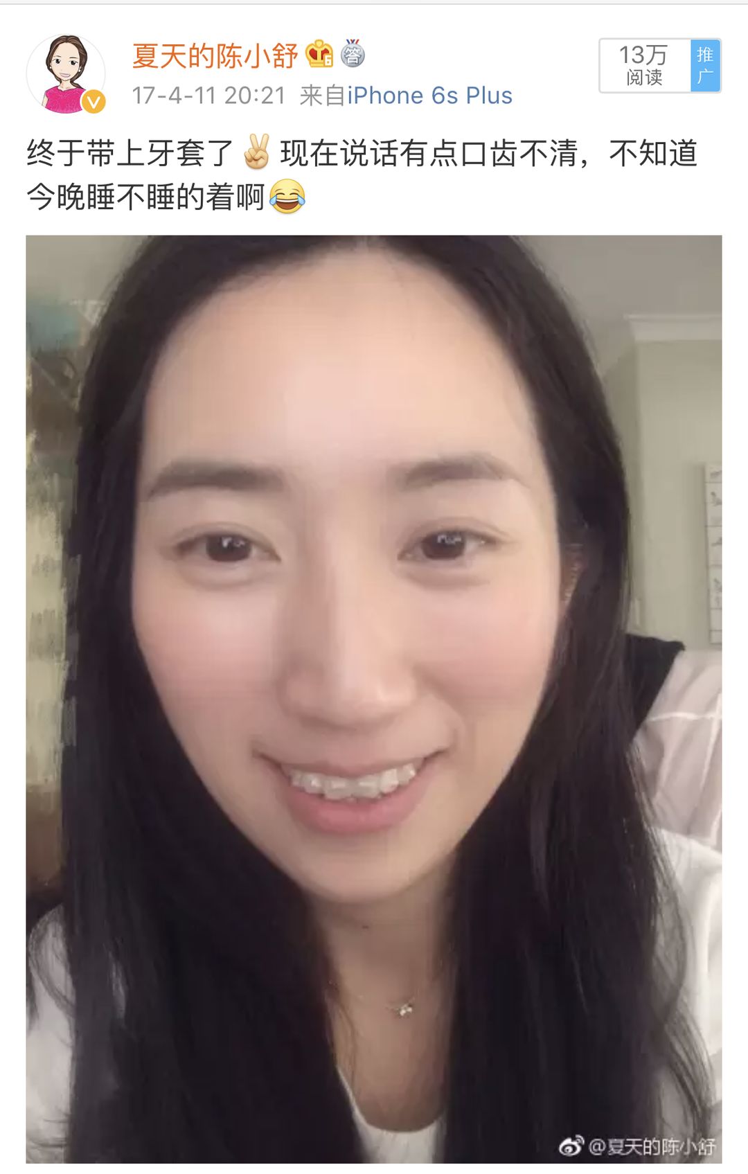 怀孕可以做乳房矫正吗,30岁哺乳期矫正牙齿的利与弊