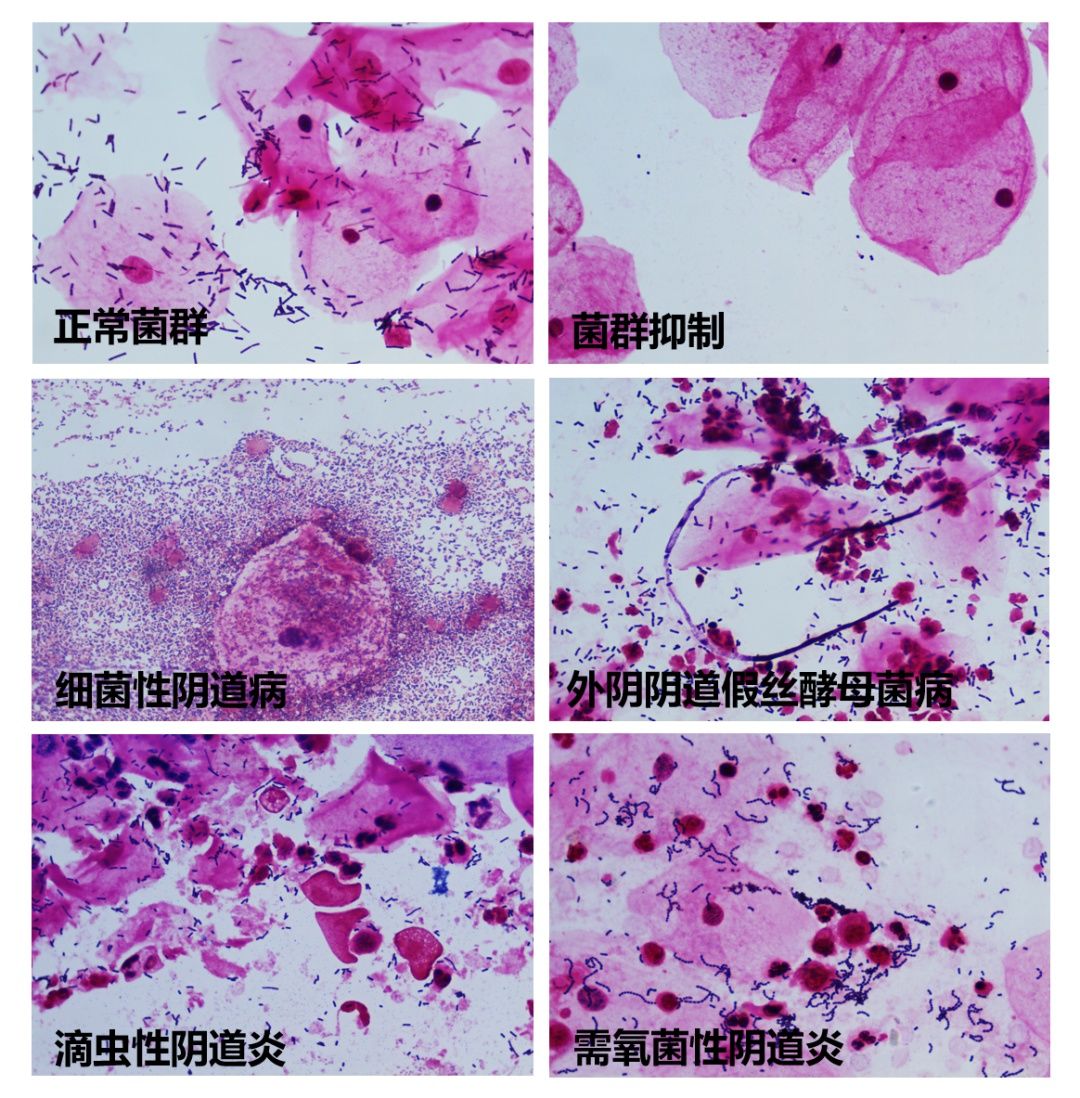 妇产要闻|大检验时代背景下的“中国女性微生态诊治中心”落户北京妇产医院