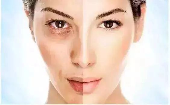 疤痕彻底消失新技术,疤痕淡化修复新技术