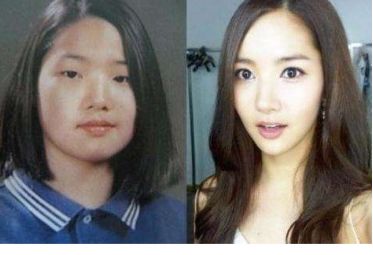 孩子脸摔破会留疤怎么办,小孩摔破脸会留疤吗