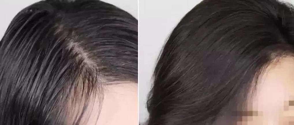 蓬松神器让头发立马蓬松,头发蓬松神器顶发根