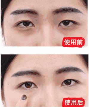 解决眼袋只需3步,不管眼袋多严重用点它