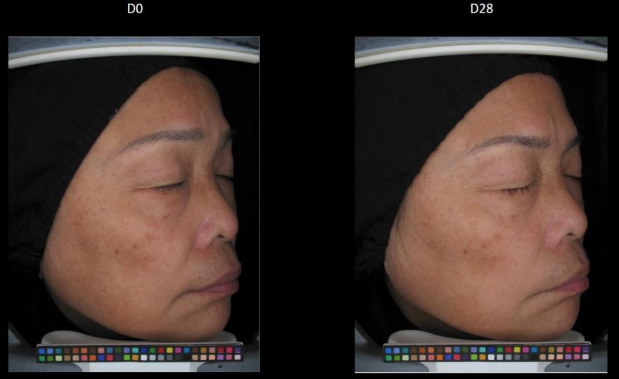 疯狂美白,这四种美白方法千万别乱试