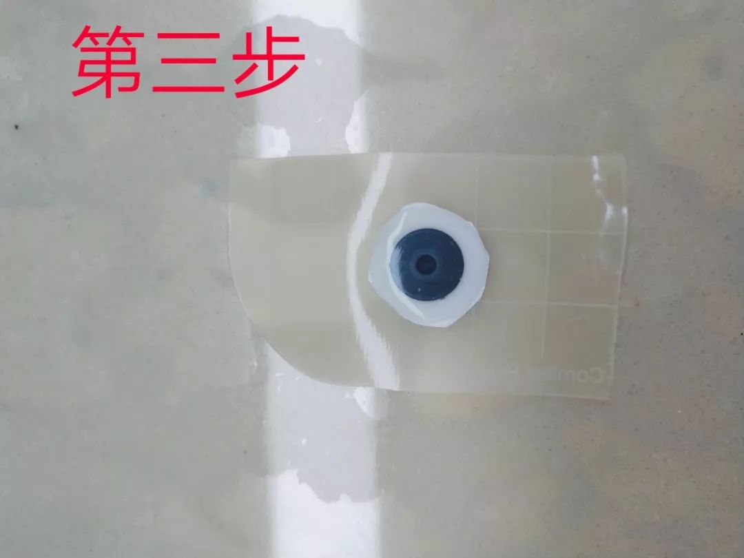 电极片皮试过敏,电极贴过敏的整改措施