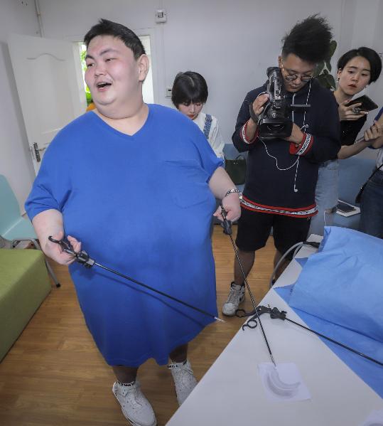 800斤第一胖手术,中国第一胖人做手术