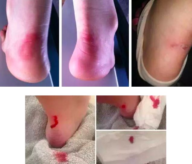 最舒适耐穿的拖鞋,质量好的耐穿的拖鞋