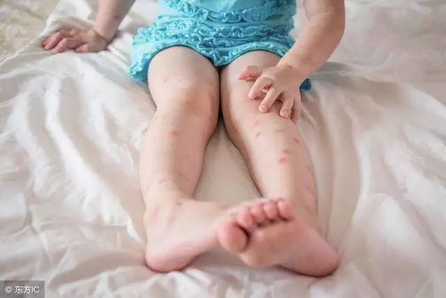 泰国青草膏驱蚊止痒防蚊虫叮咬,泰国蚊子叮咬止痒膏