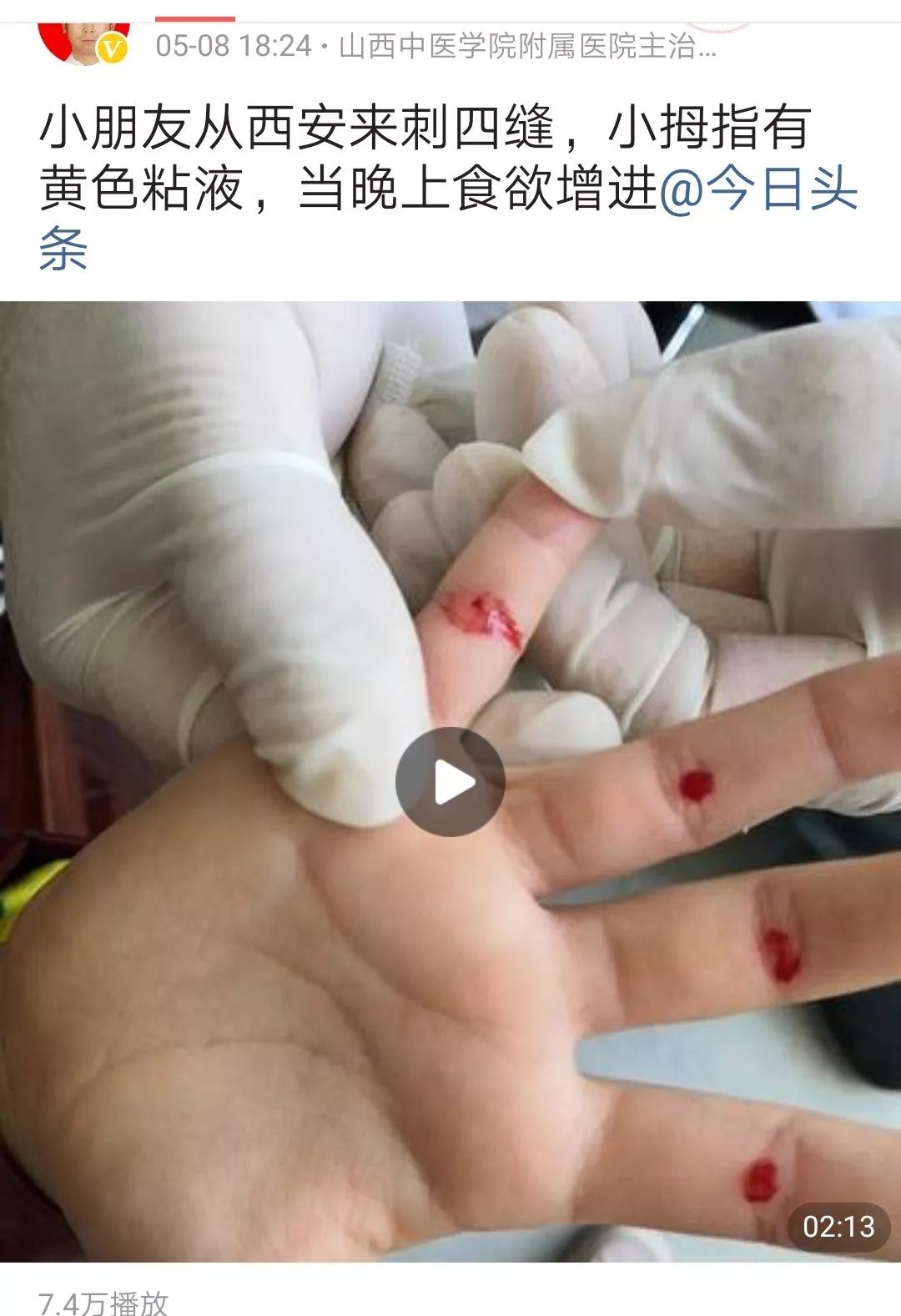 张景明讲孩子厌食挑食,儿童长期挑食厌食偏瘦是什么原因