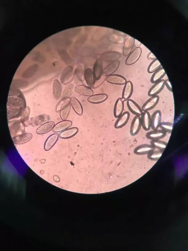 可怕！杭州4岁宝宝老是挠屁屁，大半夜还爬出白色小虫