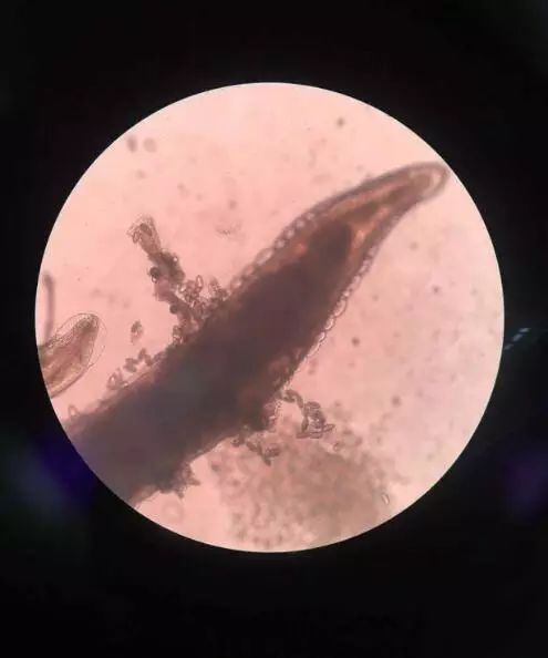 孩子屁股痒怎么解决小妙招,孩子晚上屁股痒要怎么处理