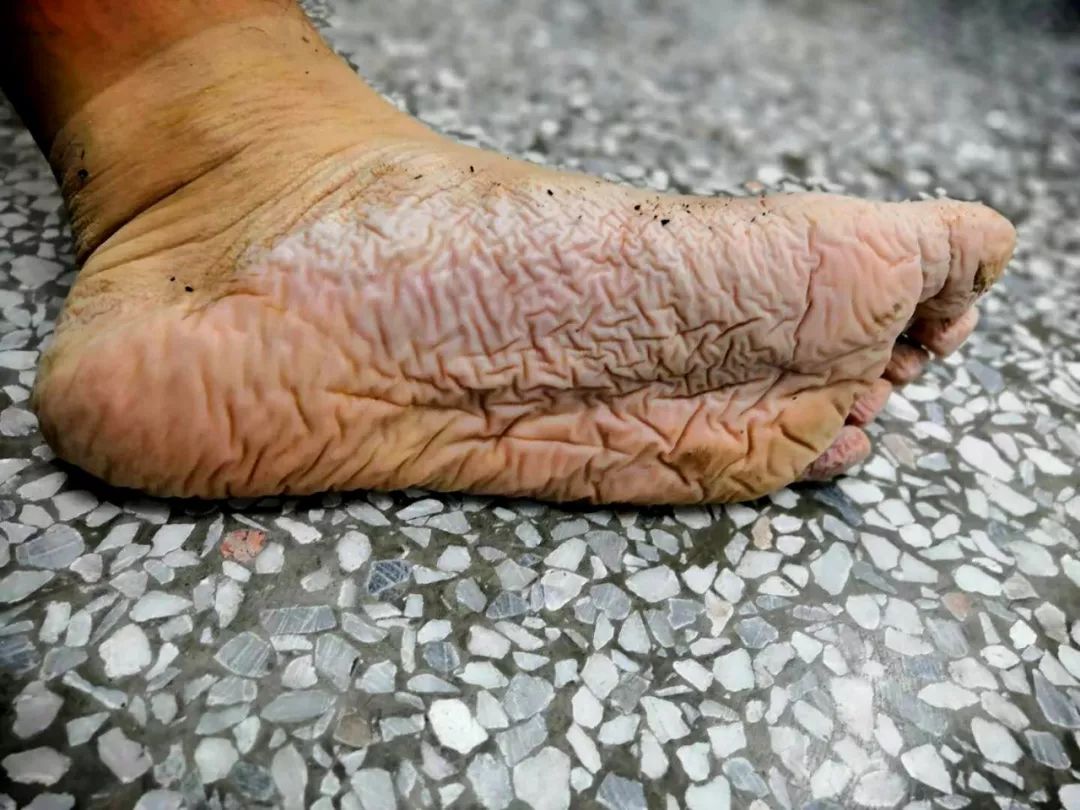 能不能不把脸拍进去，别让我妈知道是我的脚。