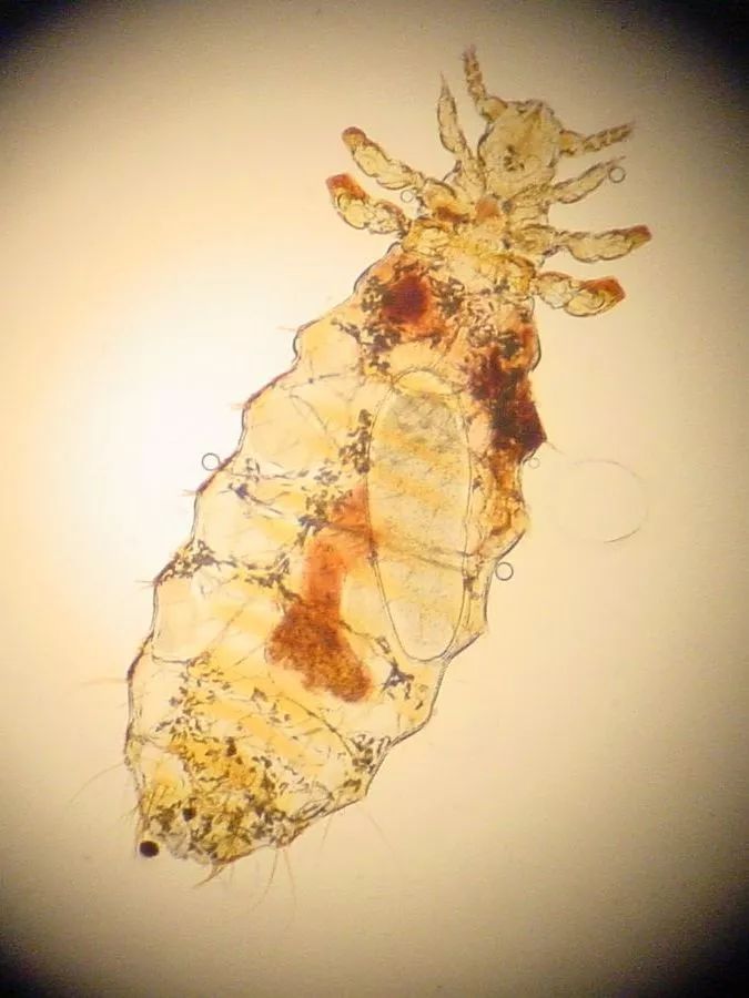 一些吸血的昆虫蜱虫,好多小虫子吸血