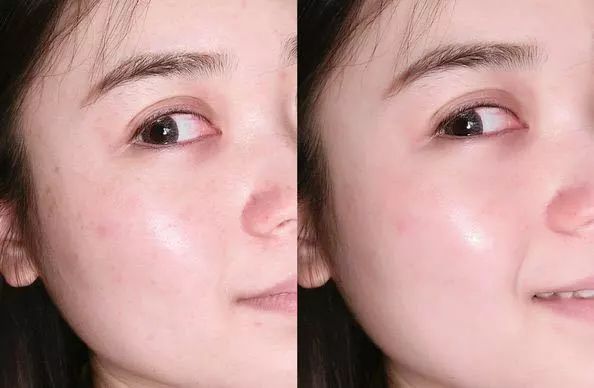 维c美白提亮推荐,抗皱维c