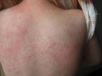 洗衣机污垢和霉菌,洗衣机加水有厕所味儿