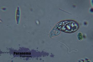 水中常见的藻类微生物图片,藏在水下的生物