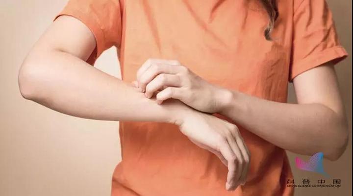 为啥被蚊子咬后越涂炉甘石越肿,被蚊子咬皮肤突然肿起来怎么治