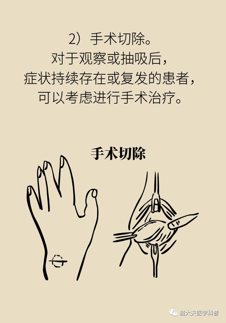 手腕长腱鞘囊肿,小孩手腕起了一个腱鞘囊肿要紧吗