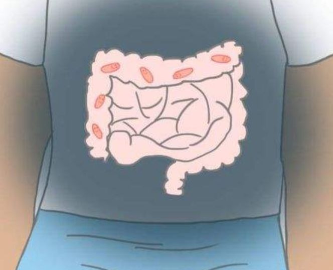 瑜伽课需要带垫子吗,瑜伽课一定要放音乐吗