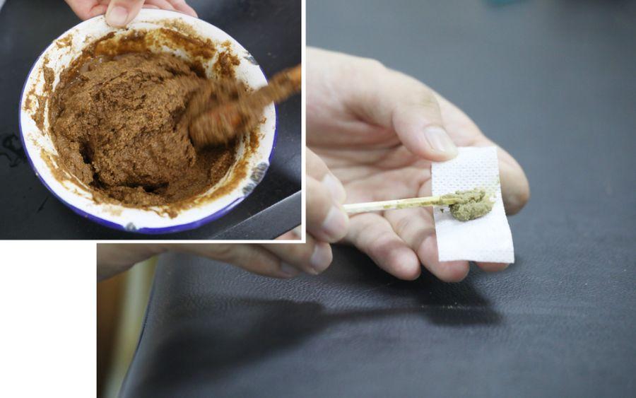 冬病夏治三伏贴2019,冬病夏治三伏贴火爆预约中