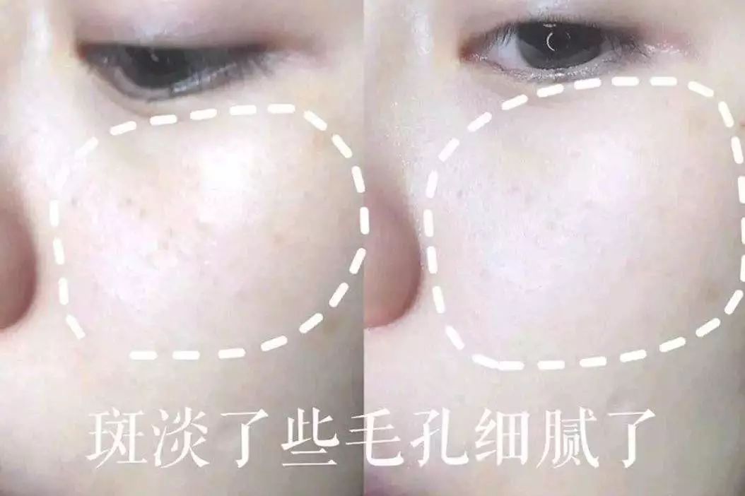 黑科技一秒祛斑,黑科技美白真的有效吗