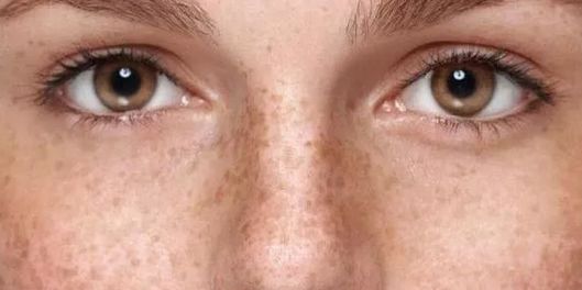 女星秒变“网瘾少女”，3C病“瘾”斑出击，失去远比看到得多