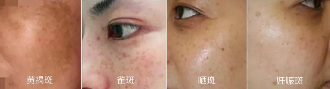 刚秀完恩爱就被分手,刚刚秀完恩爱就分手