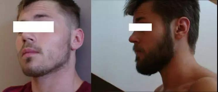 4岁儿童长胡须正常吗,4岁小孩长胡须