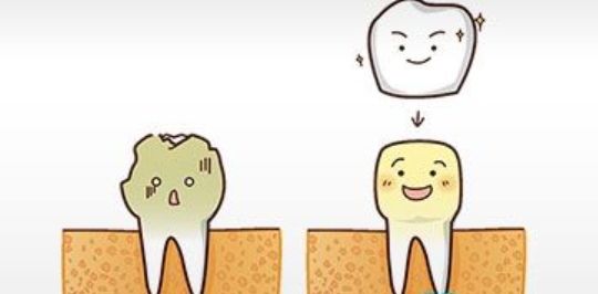 根管治疗后做牙套还要补牙吗,做牙套需要根管治疗吗