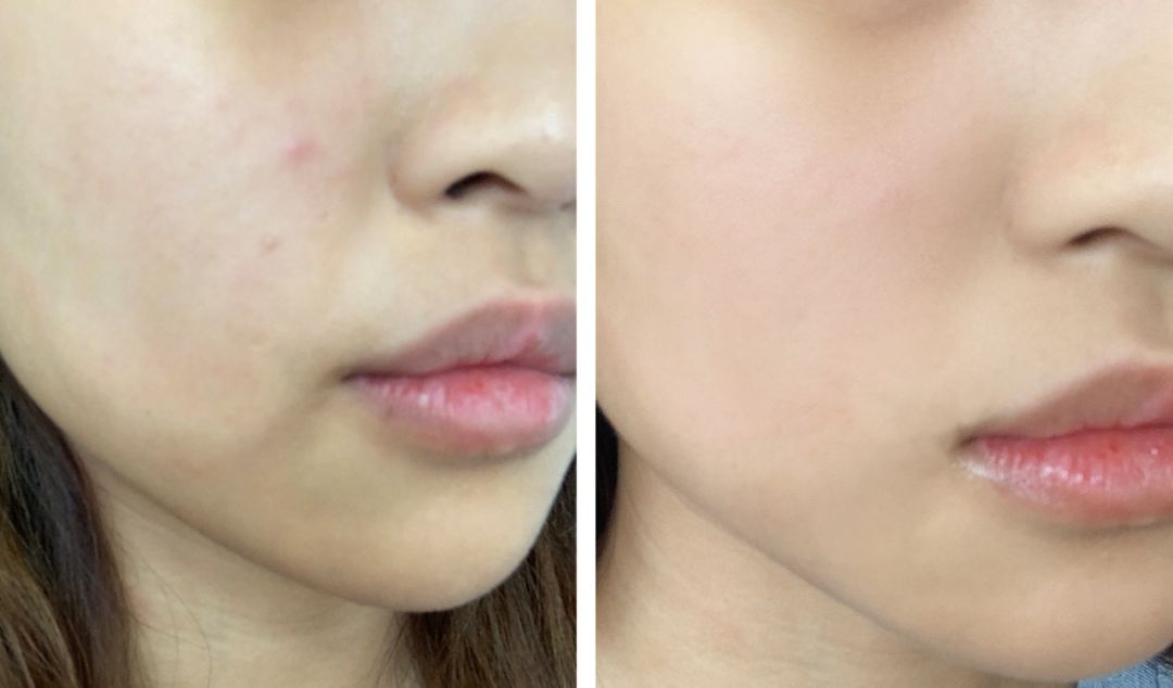 真丝枕套真丝眼罩,真丝枕套加眼罩