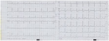大动脉炎的最新疗法是什么,大动脉炎有治愈的案例吗