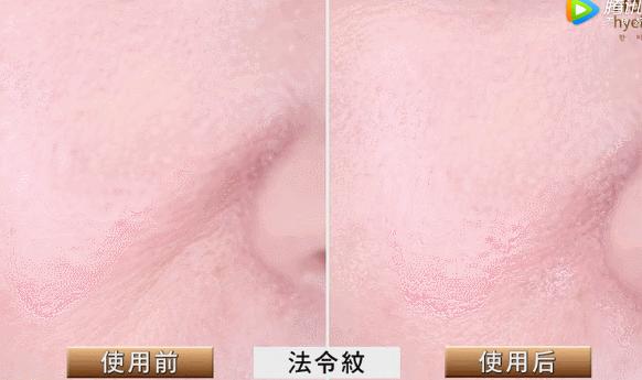 解决皱纹色斑粗糙干燥就用这一套,淡化各种皱纹特别快的好方法