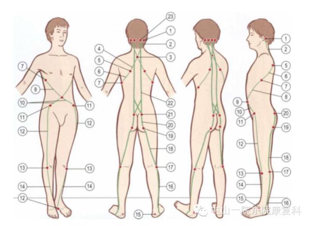 筋膜的康复训练方法,12条筋膜链解析及治疗手法