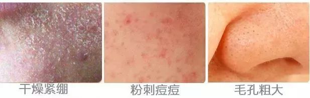 新西兰草本植物精华,新西兰精华液护肤品