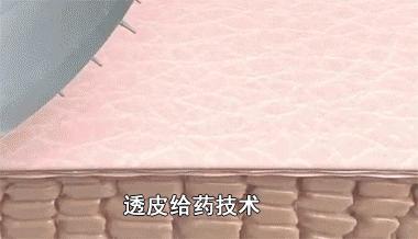 法令纹眼纹一个都逃不掉,法令纹和眼纹怎么才能有效改善