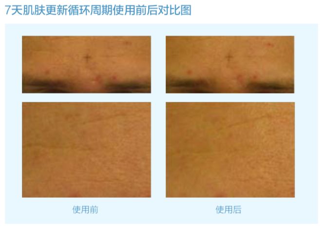 薇诺娜玻尿酸乳液 (德国抗皱玻尿酸原液)